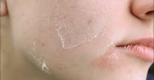 Gentle Peel Facial